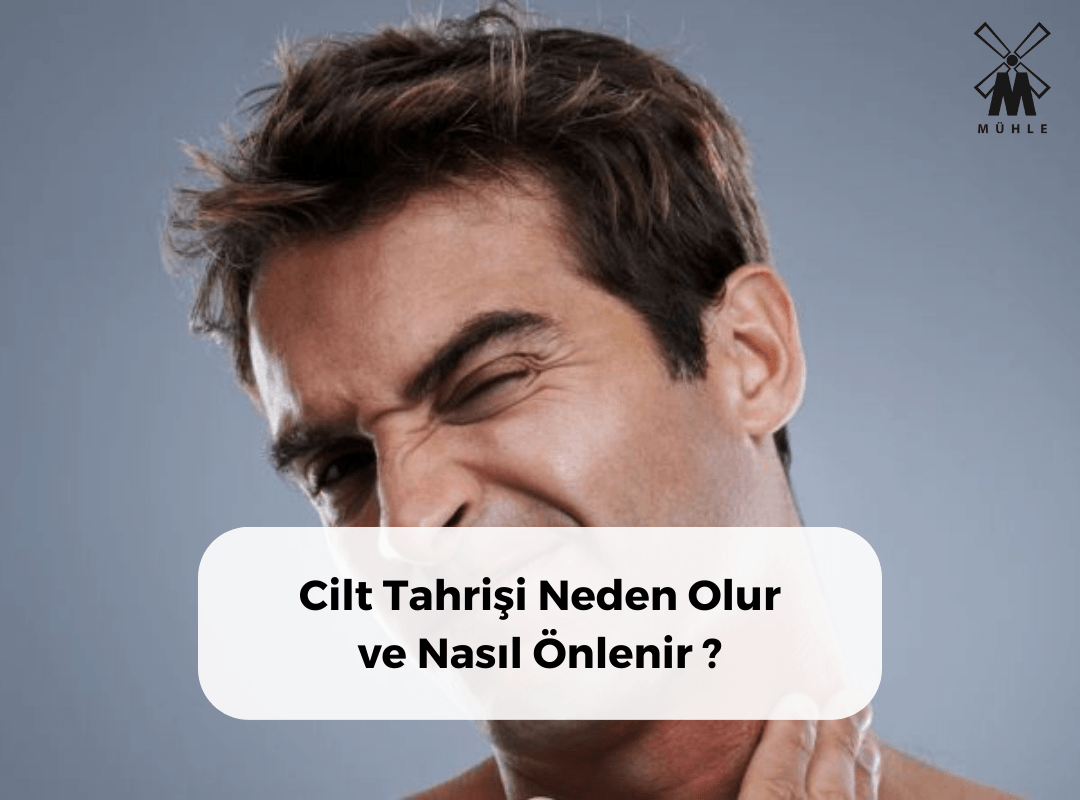 Cilt Tahrişi Neden Olur ve Nasıl Önlenir?